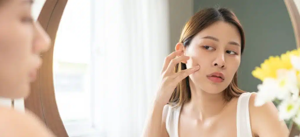 คอลลาเจน (Collagen)